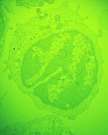 Macrophage cell in early stages of infection with African swine fever virus, magnified about 1,000x. 